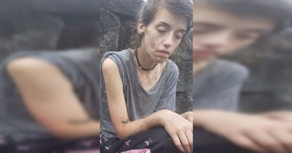 El impactante 'antes y después' de una joven adicta a las drogas